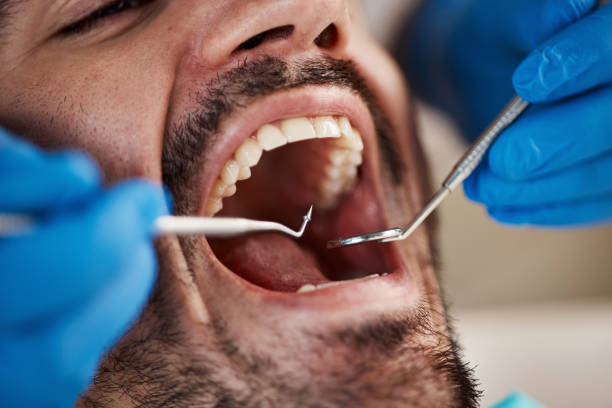 Sleep Apnea Treatment in St Peter, WI